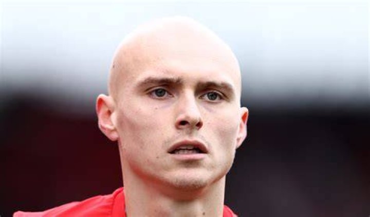 Footballer: What Happened To Will Smallbone Hair? Illness Alopecia -Details To Know