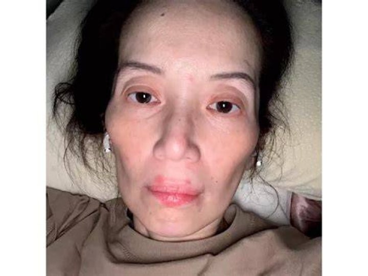 HIV: What Happened To Kris Aquino? Weight Loss And Health Problems -Details To Know