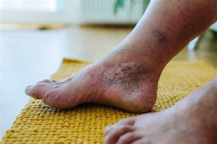 Jacqi Vene Wikipedia Feet: Everything To Know
