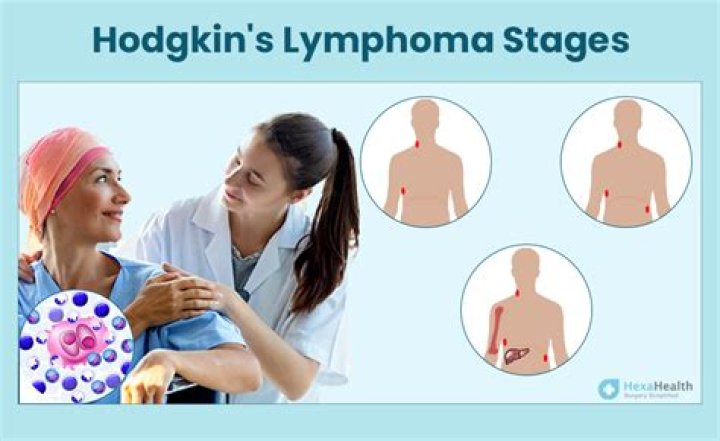 Kate Haskell ITV Weather Cancer, Hodgkin Lymphoma Update 2023: Illness And Health