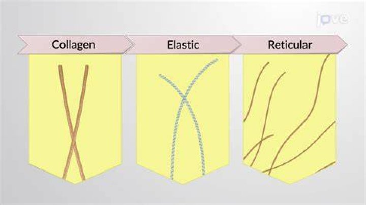 What is the matrix composed of in elastic cartilage
