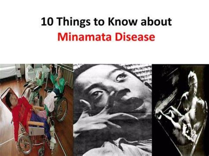 Who Is Akiko Iwase? Everything To Know About The Cast Of Minamata